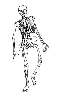 Skelet koxartrózy
